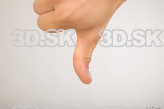 Thumb of athelete Timothy 0005